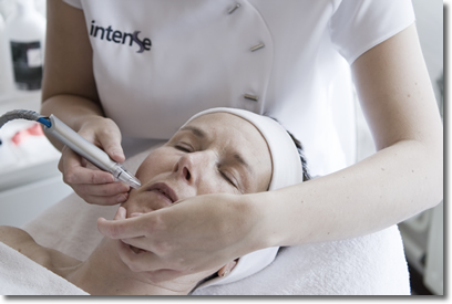 Microdermabrasie