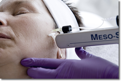 Een injectie tijdens een mesotherapie behandeling