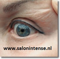 Verwijderen permanent make-up - na
