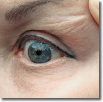 Verwijderen permanent make-up - na