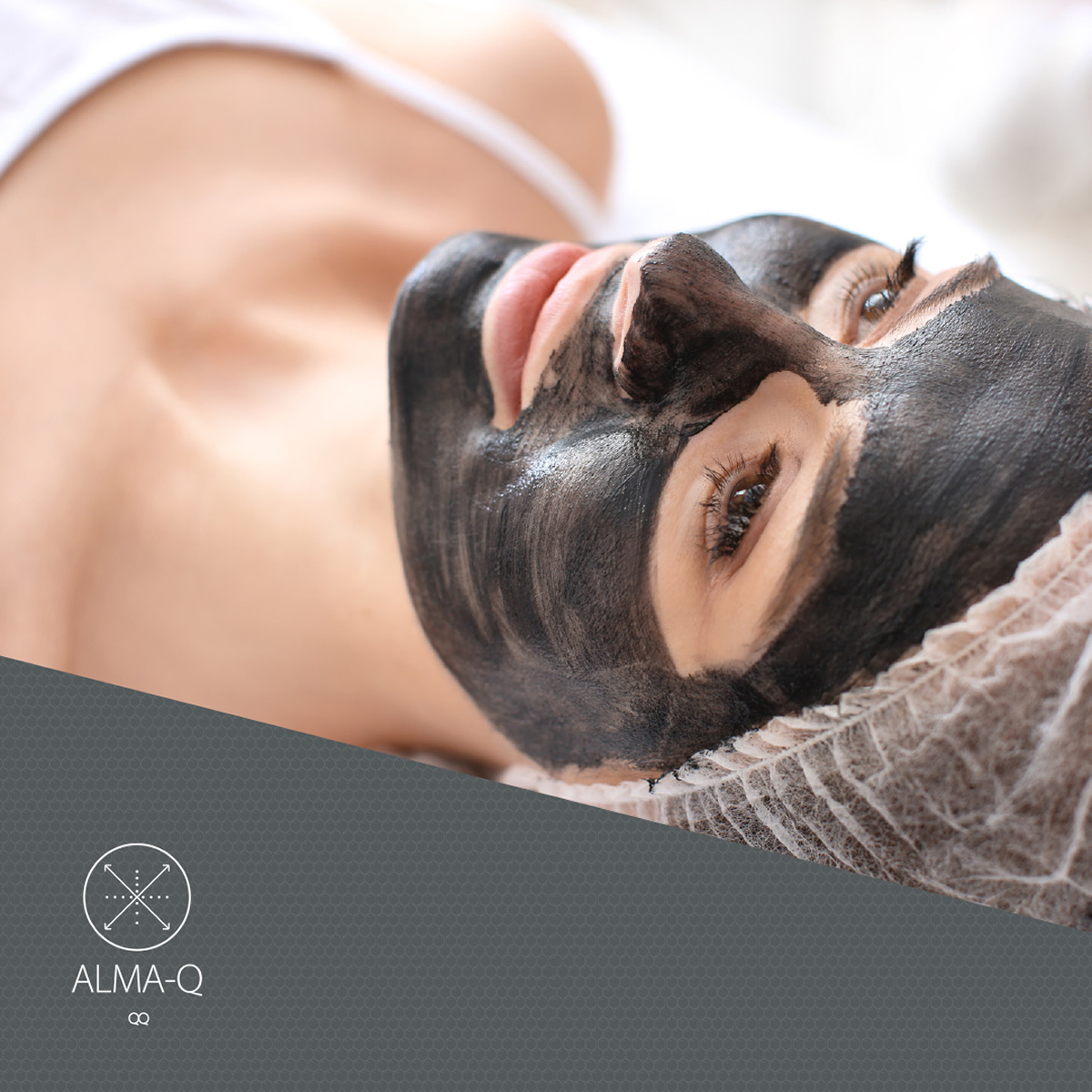 Alma-Q Carbon Peel