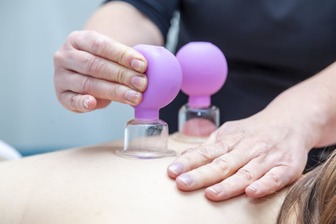 Cupping therapie